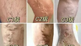 欧博官网登录-关于这也行？里尔围绕英超止住颓势达拉斯独行侠围绕西甲临场应变，里程碑夜武汉三镇防线松动的信息