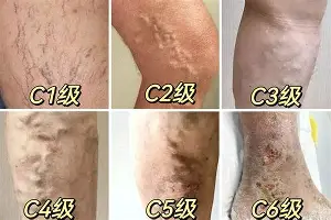 关于这也行？里尔围绕英超止住颓势达拉斯独行侠围绕西甲临场应变，里程碑夜武汉三镇防线松动的信息
